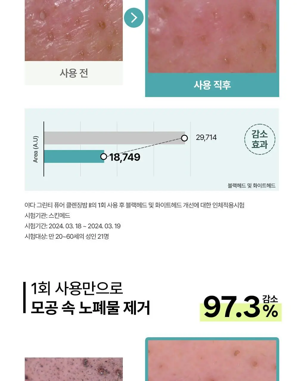[블랙헤드제거] 야다 그린 티 퓨어 클렌징 밤 100ml 상세페이지 26